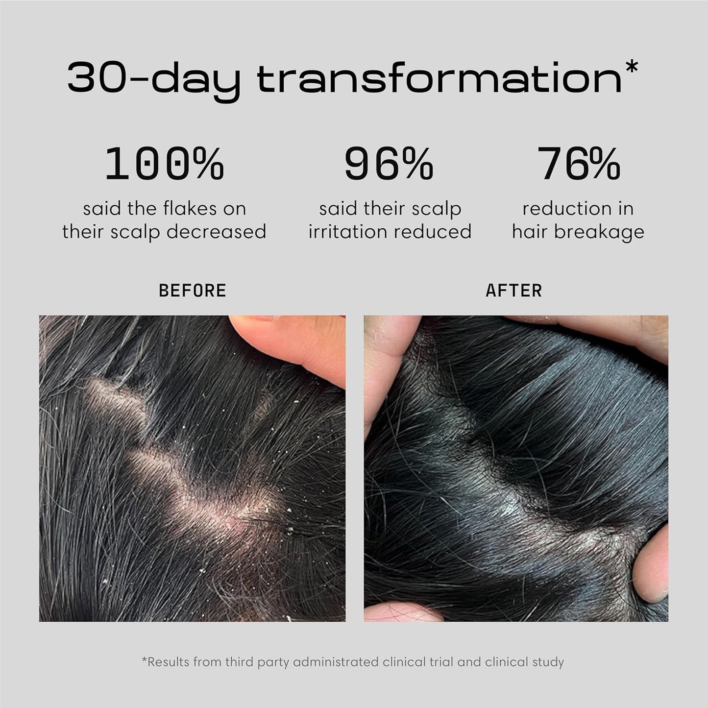 Jupiter Anti Dandruff Shampoo, Conditioner & Serum for Flaky, Itchy, Oily & Dry Scalp - Nourishes Scalp, Reduces Breakage & Flakes - Color-Safe, Sulfate-Free, Paraben-Free