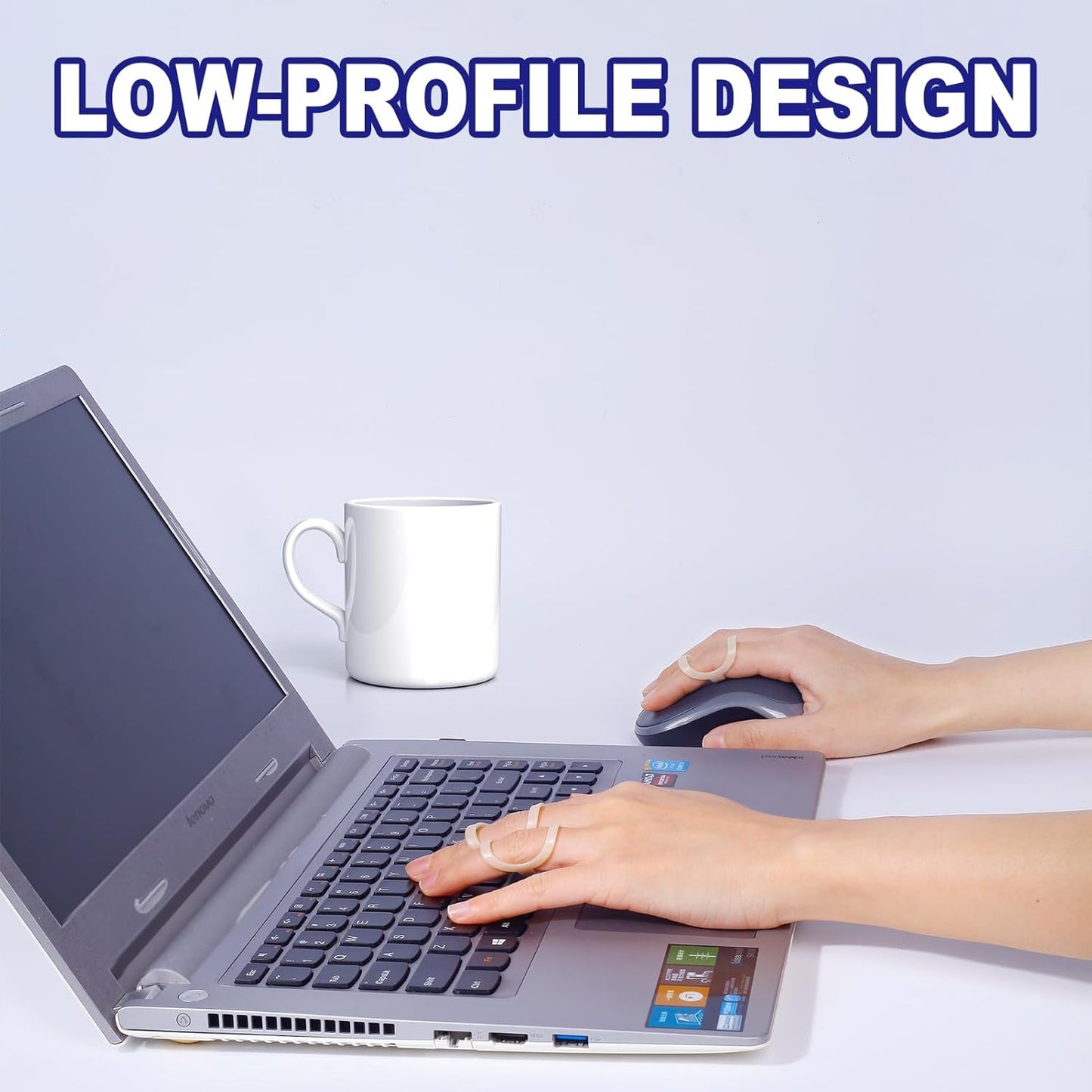 8Pcs Oval Finger Splints & Click-Lock Adjustment Kit, 4 Graduated Finger Ring Splint & 4 Splint Adjustment, Finger Braces for Arthritis, Mallet, Straightening, Support (Size 8-11)