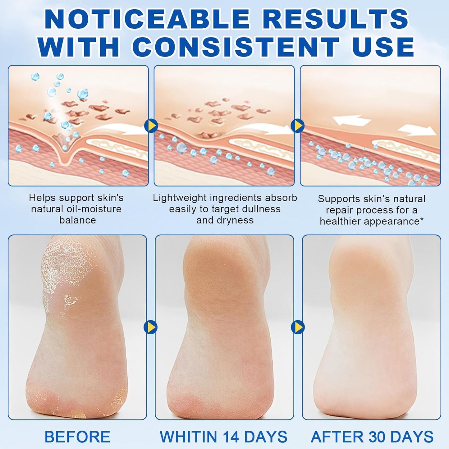 60% Urea + 2% Salicylic Acid Foot Cream–Ultra-Moisturizing Formula, Exfoliates Dead Skin, Softens Dry, Cracked Skin on Feet, Knees, Hands, Elbows. Helps soften callused, rough, or tender areas 2.82oz