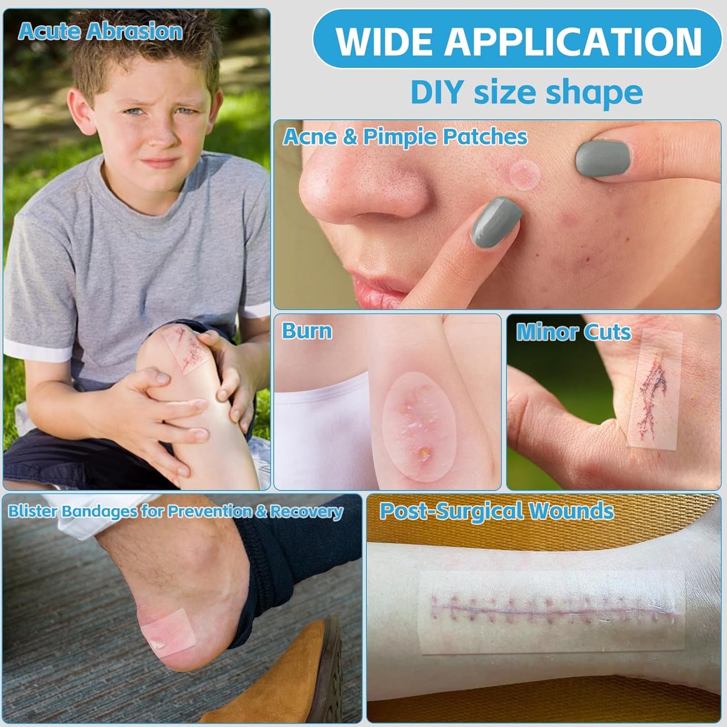 Hydrocolloid Bandages for Wound Care, Extra Large Medical-Grade Hydrocolloid Roll with Self-Adhesive, Ultra Absorbent, Flexible & Waterproof, DIY Size & Shape First Aid Kit Essential (2in*16ft)