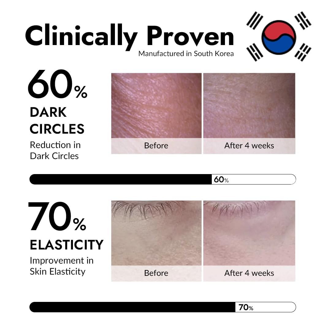 MIZON Under Eye Patches for Puffy Eyes & Dark Circles, 24K Gold & Snail Mucin, 60 Pcs – Anti-Wrinkle Collagen & Peptide Formula – Moisturizing Korean Eye Mask for Elasticity