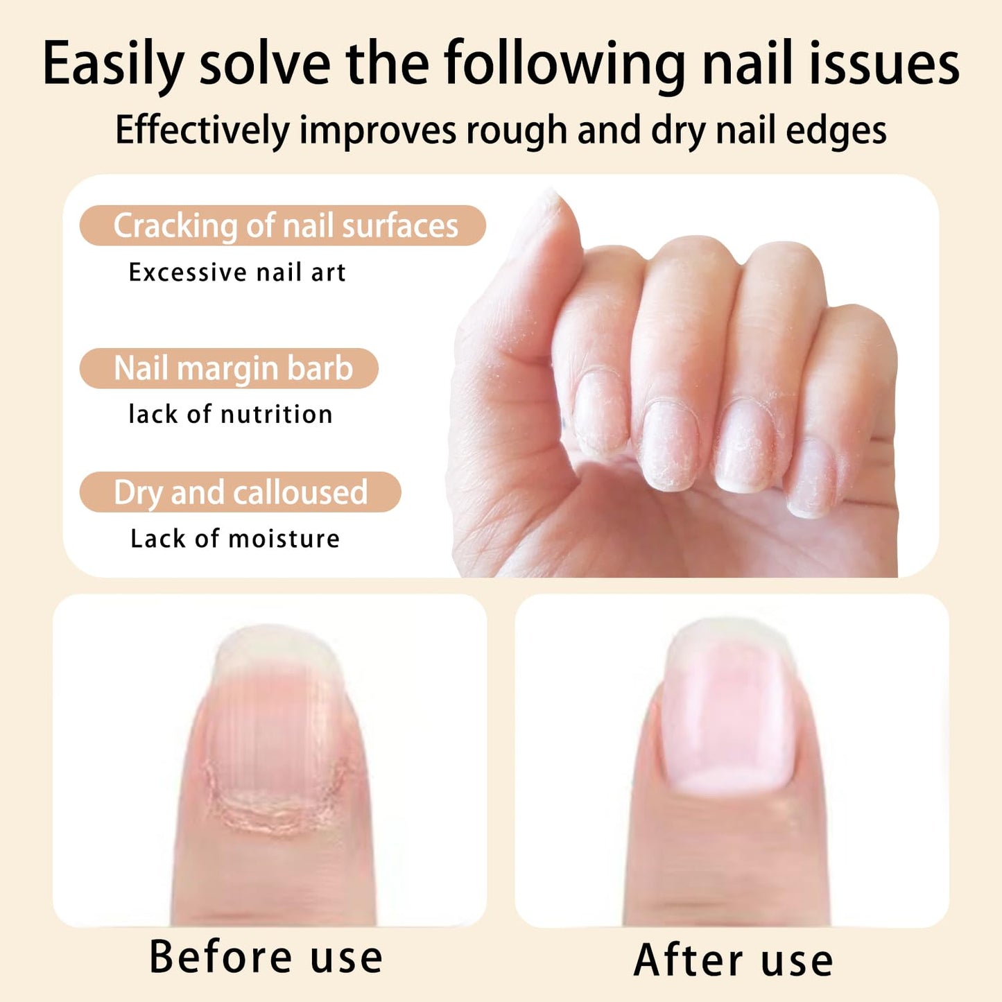 Cuticle Oil Pen Sweet Almond Nail Growth Serum and Repair Treatment Hydrating Oil for Dry Cuticles and Skin Cuticle Buddy Revitalize Nails with Radiant (6pcs pens)