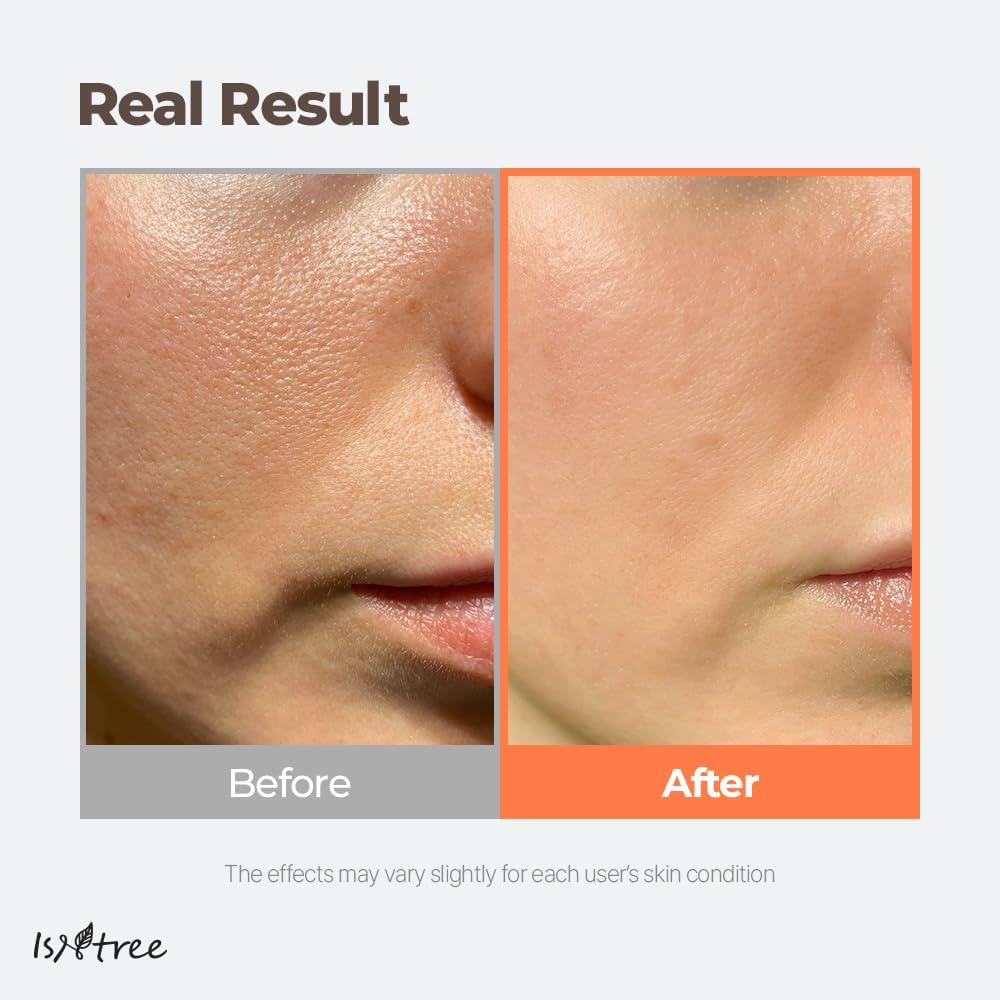 ISNTREE Green Tea Fresh Toner 200ml, 6.76 fl.oz | Korean Skincare | Toner for Oily Skin | Sebum Control | Hydrating and Refreshing