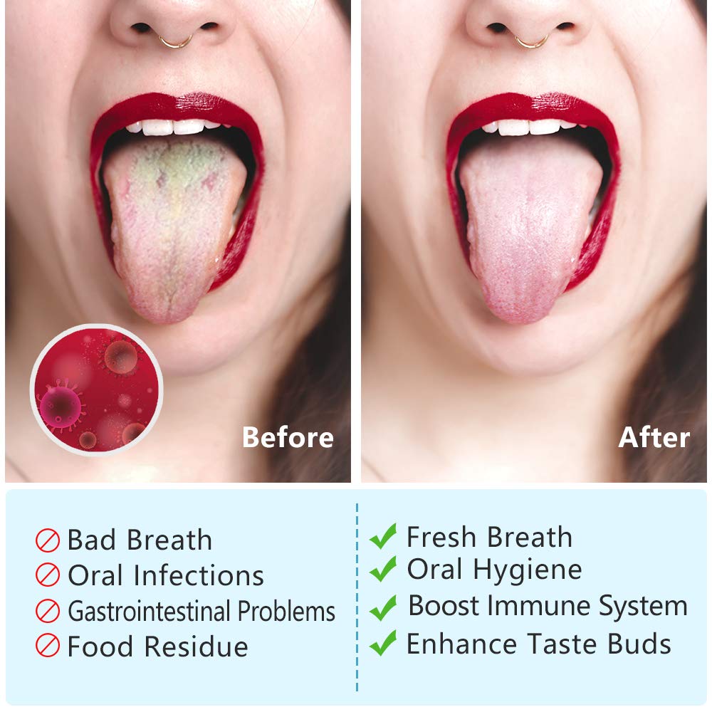 MORGLES Metal Tongue Scraper, 4 Pcs Tongue Cleaners with Case for Adults