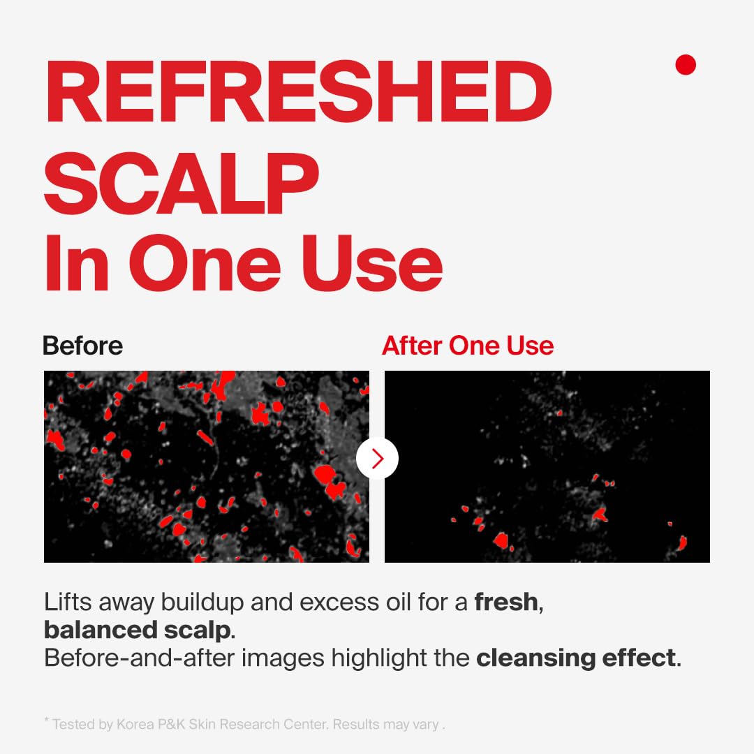 Dr.FORHAIR Folligen Shampoo | Korean Hair Care | Clarifying, Anti Dandruff, Scalp | For Hair Thickening & Fuller Looking, 16.91 fl oz