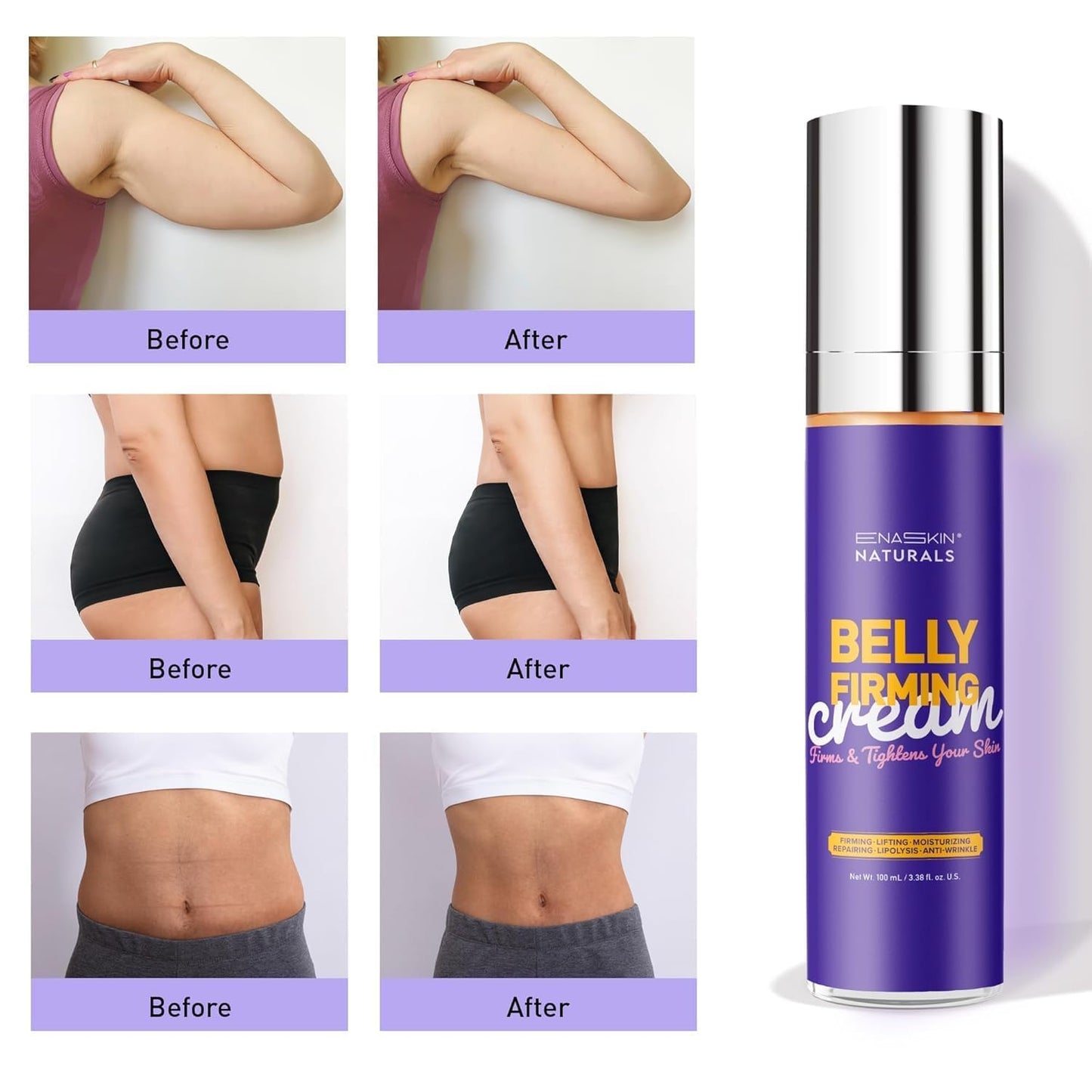 Enaskin Naturals Belly Firming Cream: Hibiscus & Honey Skin Tightening Cellulite Cream - Women Body Lotion for Firmness and Lift of Thighs & Stomach - Tummy Butter Stretch Marks - 120ML