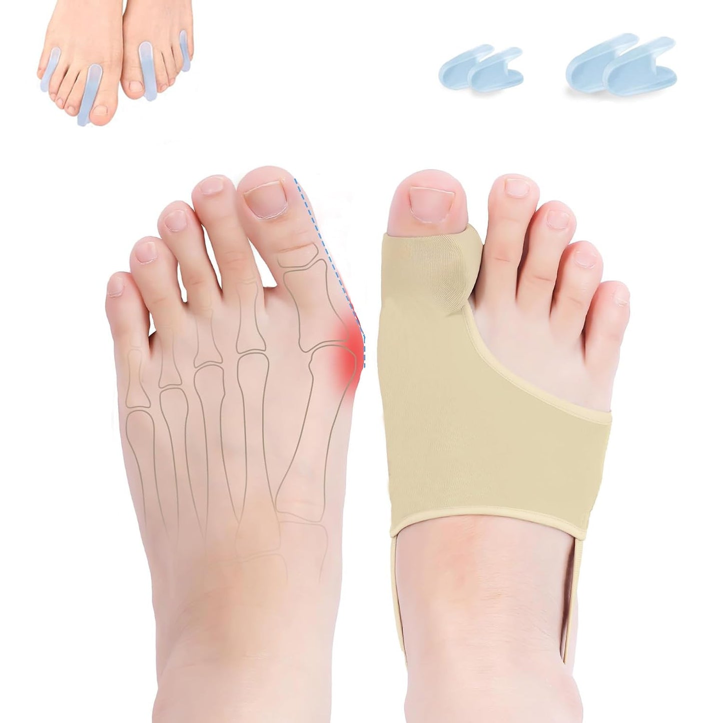 Bunion Relief Sleeves Bunion Pads Brace Cushions Toe Straightener with Silicone Gel Big Toe and Pinky Separator Spacer Hallux Valgus Relief Kit Pack (Small)