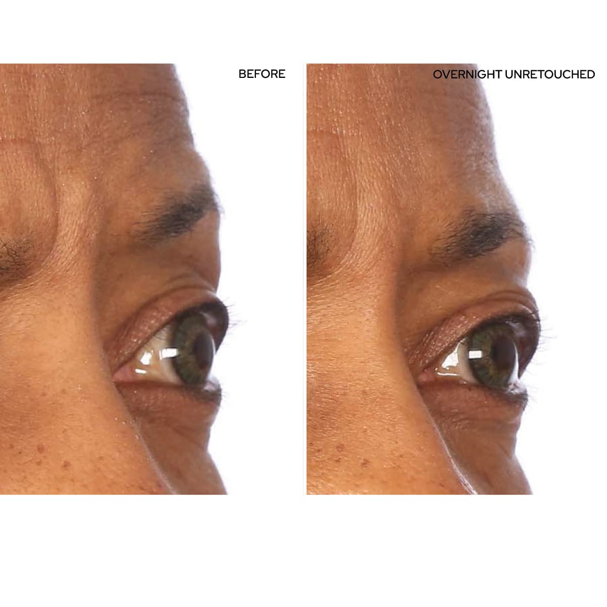 SiO Beauty SuperLift Forehead, Eye, & Lip Anti-Wrinkle Silicone Patches - Reduce Brow, Smile, and Under Eye Wrinkles Overnight