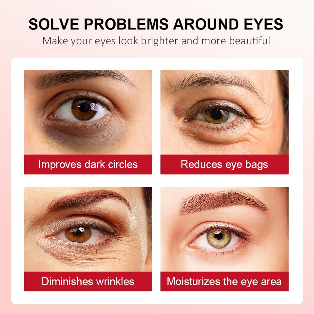 Retinol Eye Stick-Peace Out Dark Circles with this Anti-Aging Eye Cream and Brightening Balm Visible in 3-4 Weeks Reduces Fine Lines and Puffiness, Banishes Wrinkles and Dark Circles under Eye