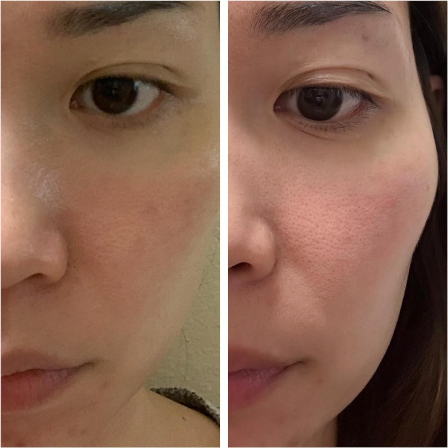 Korean Skin Care Set - Simplified Kbeauty Skincare Kits - Asian Skincare Facial Kit & Sets with Water Based Cleanser, Essence Toner, Under Eye Patches, Face Mask Sheets, Self Care Gifts For Women