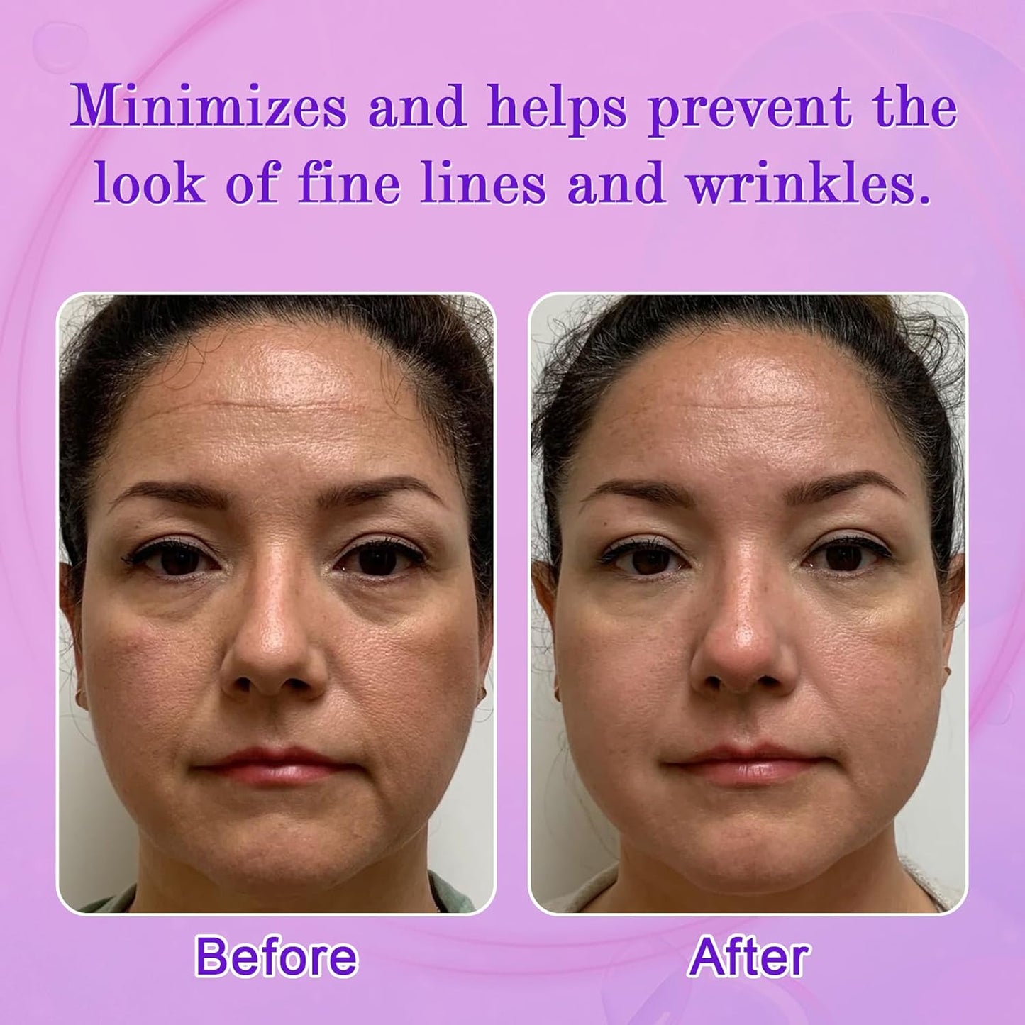 Facial Wrinkle Patches, Anti Wrinkle Patches for Forehead, Face, Frown Lines, Smile Lines, Overnight Wrinkle Pads to Reduce Fine Lines, Reusable Anti-Aging Face Patches, 160 pcs