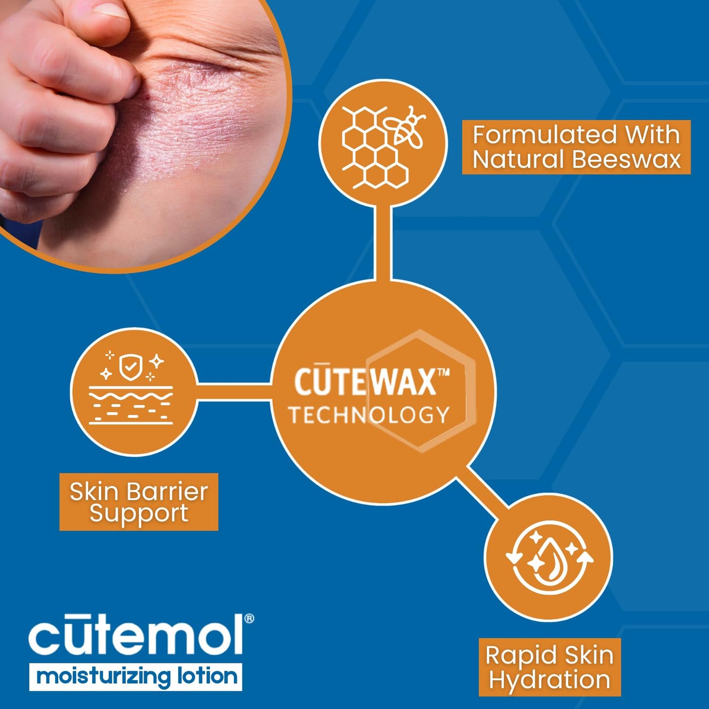 Cutemol Moisturizing Lotion - Daily Moisturizing Lotion - Fragrance-Free & Non-Greasy - Moisturize, Hydrate, Protect, & Relieve Dry Skin - 13.5oz