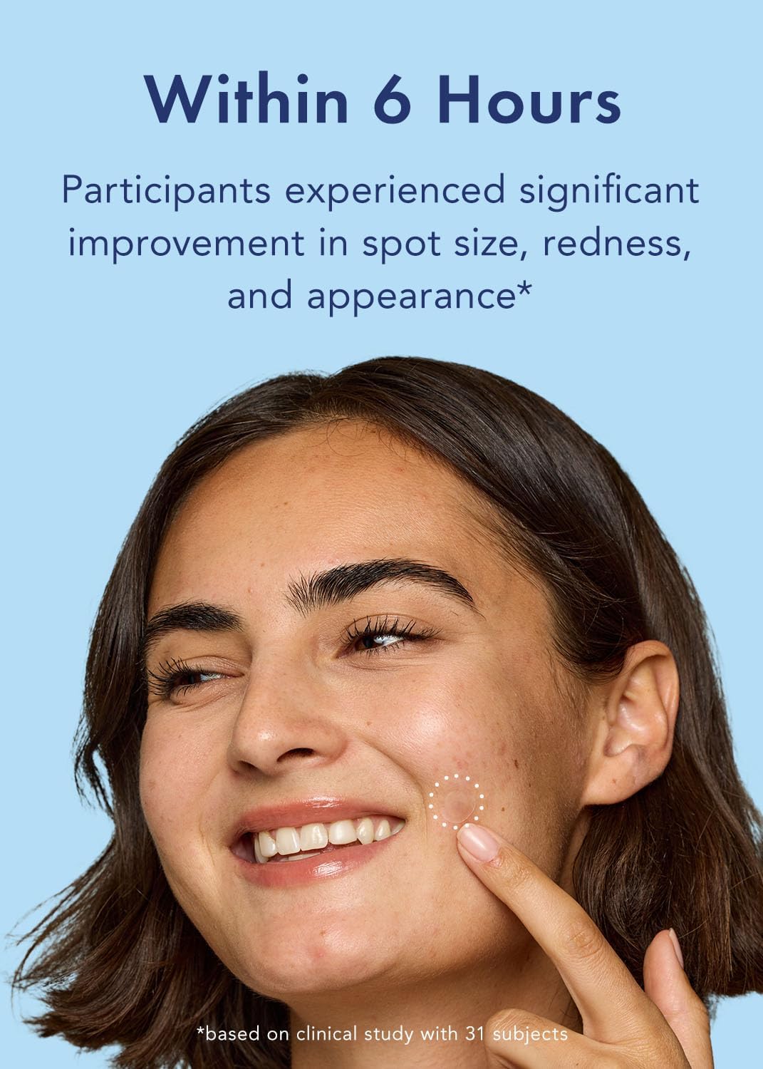 Rael Pimple Patches, Miracle Retinol Spot Cover - Hydrocolloid Acne Patch for Face, Absorbing Zits & Blemishes, PM Advanced Treatment, Facial Sticker (72 Count)