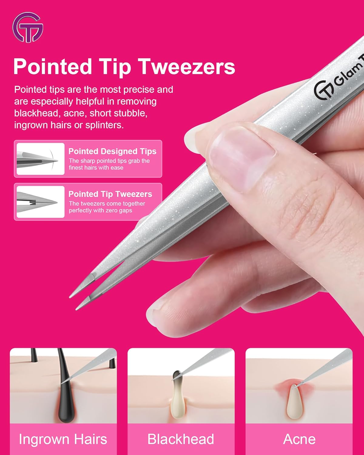 Expert Slant and Point Tip Tweezer Set with Exclusive Storage & Carrying Case, GlamTweeler Sharp & Precision Tweezer Set for Eyebrows, Facial Hairs & Fine Hairs Removal (Sparkle Baby Pink + Silver)