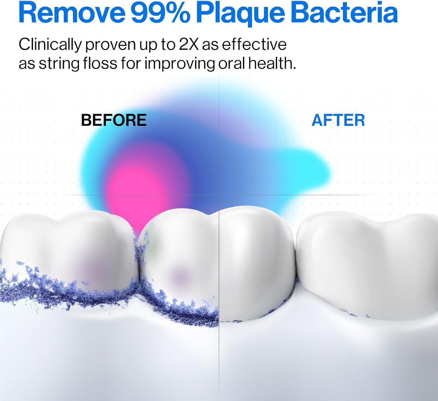 usmile C10 Portable Water Flosser – Travel-Friendly, 95-Day Battery, 4 Modes, 360° Nozzle, 180ml Tank, IPX7 Waterproof, Dentist-Recommended for Braces, Implants & Sensitive Gums (White)