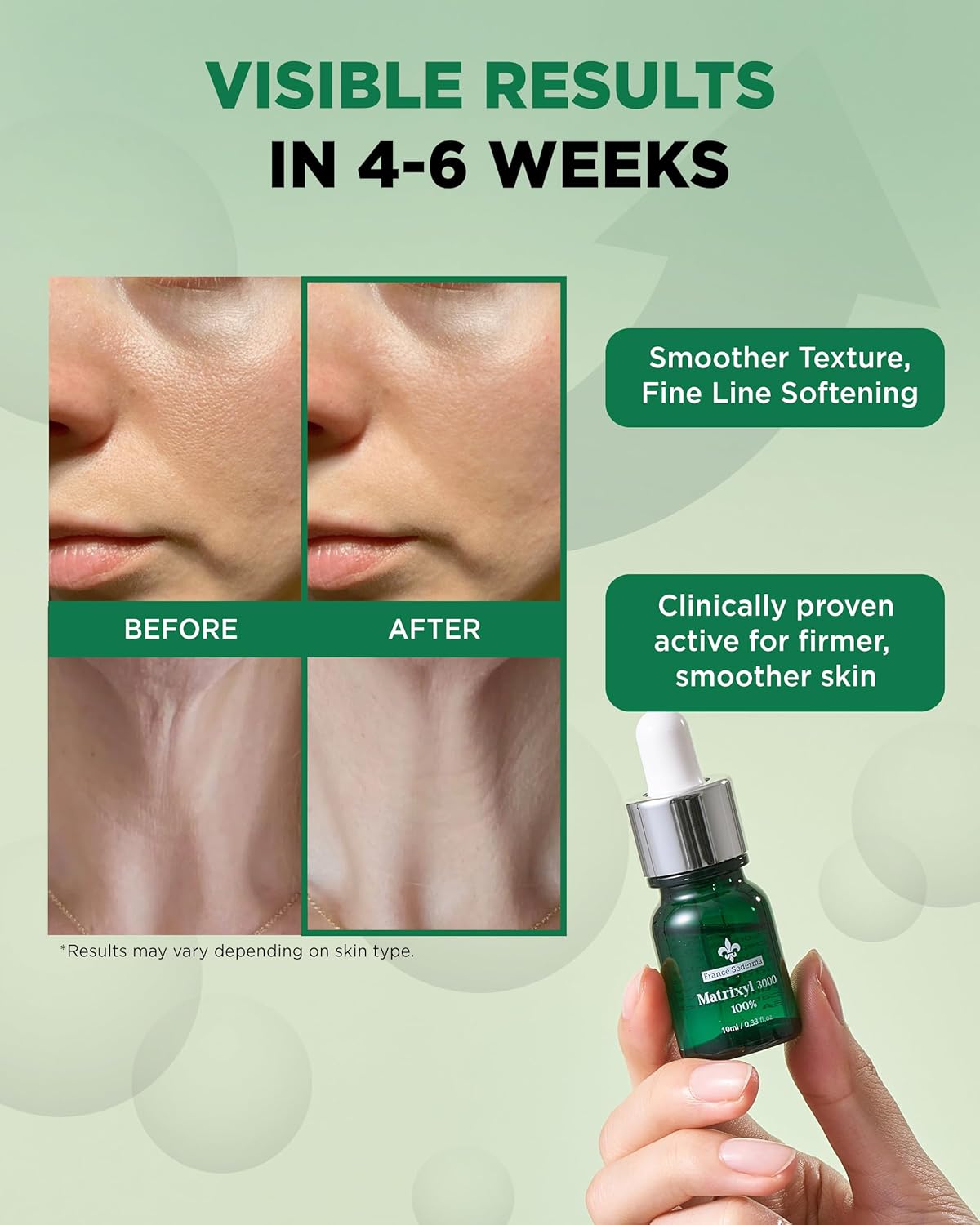 Matrixyl 3000 100% Serum Skincare – Pure Peptide Complex Anti-Aging Facial Ampoule from France Sederma, Collagen Boosting Wrinkle Treatment, Perfect for Layering & DIY, 0.33 fl.oz (10ml) 3 Pack