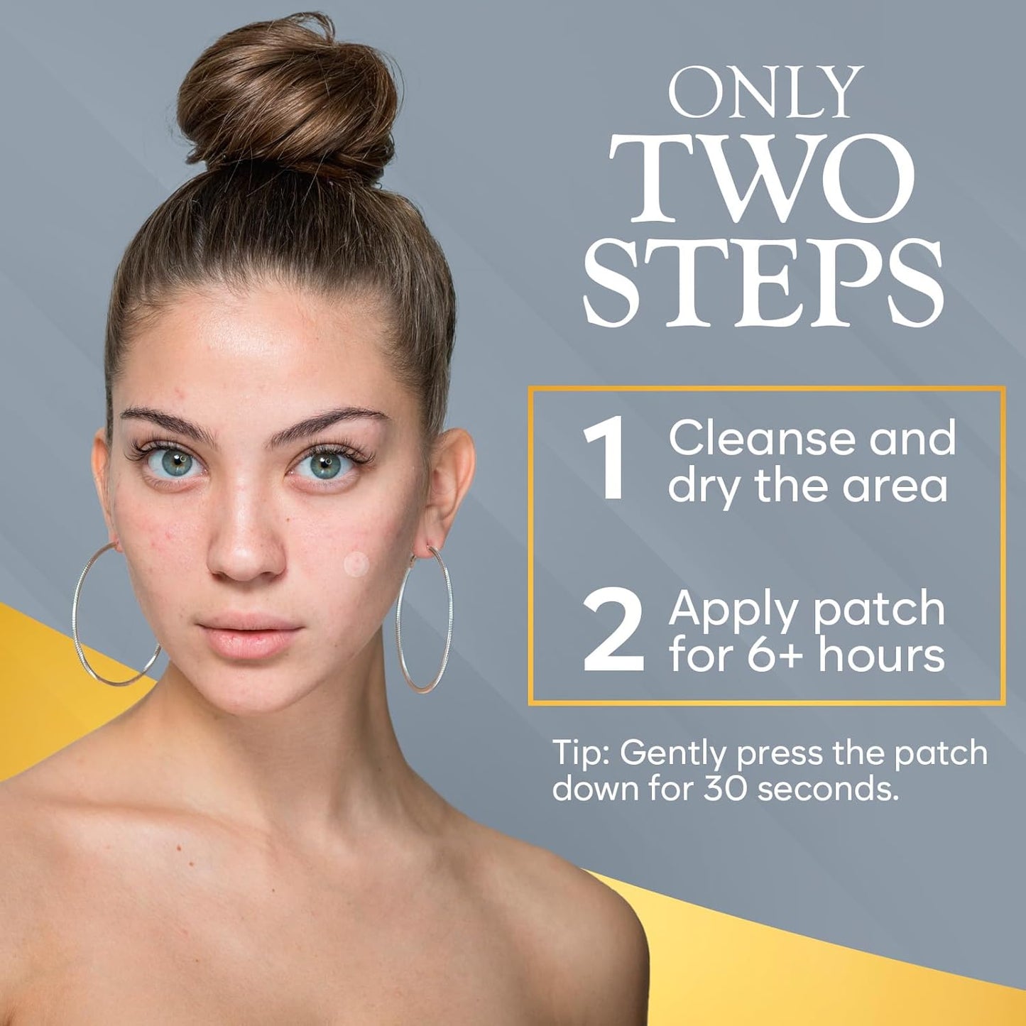 Microdart Acne Patch, Zit Patches for Cystic Acne Overnight Care, Cystic Acne Coverage, Pimple Patches Microdart Technology - Salicylic & Hyaluronic Acid (12 Count)