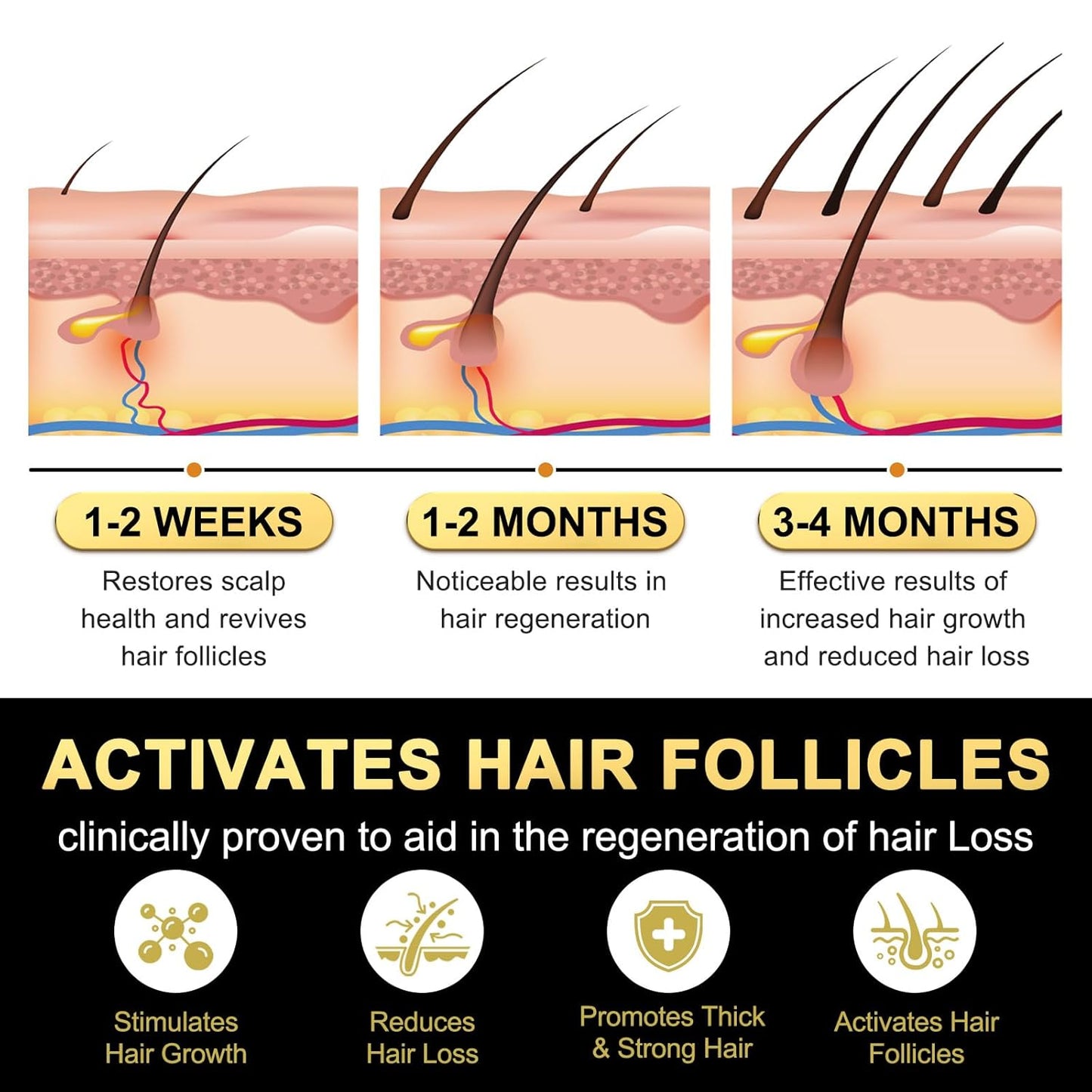 5% Minoxidil for Men and Women Hair Growth Serum, Biotin Hair Growth, Hair Regrowth Treatment for Scalp Hair Loss Hair Thinning for Thicker Longer Fuller Healthier Hair (Pack of 1)