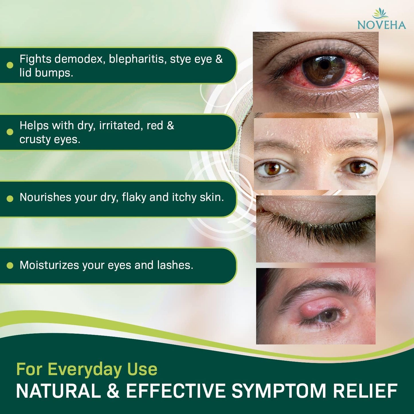 NOVEHA Demodex Eyelid Cleanser Foam | Extra Strength Tea Tree Oil Formula | Daily Face Wash For Eyelash, Demodex, MGD, Stye Eyes, Eye Irritations & Skin Dryness, 3.38 fl oz (3 Pack)