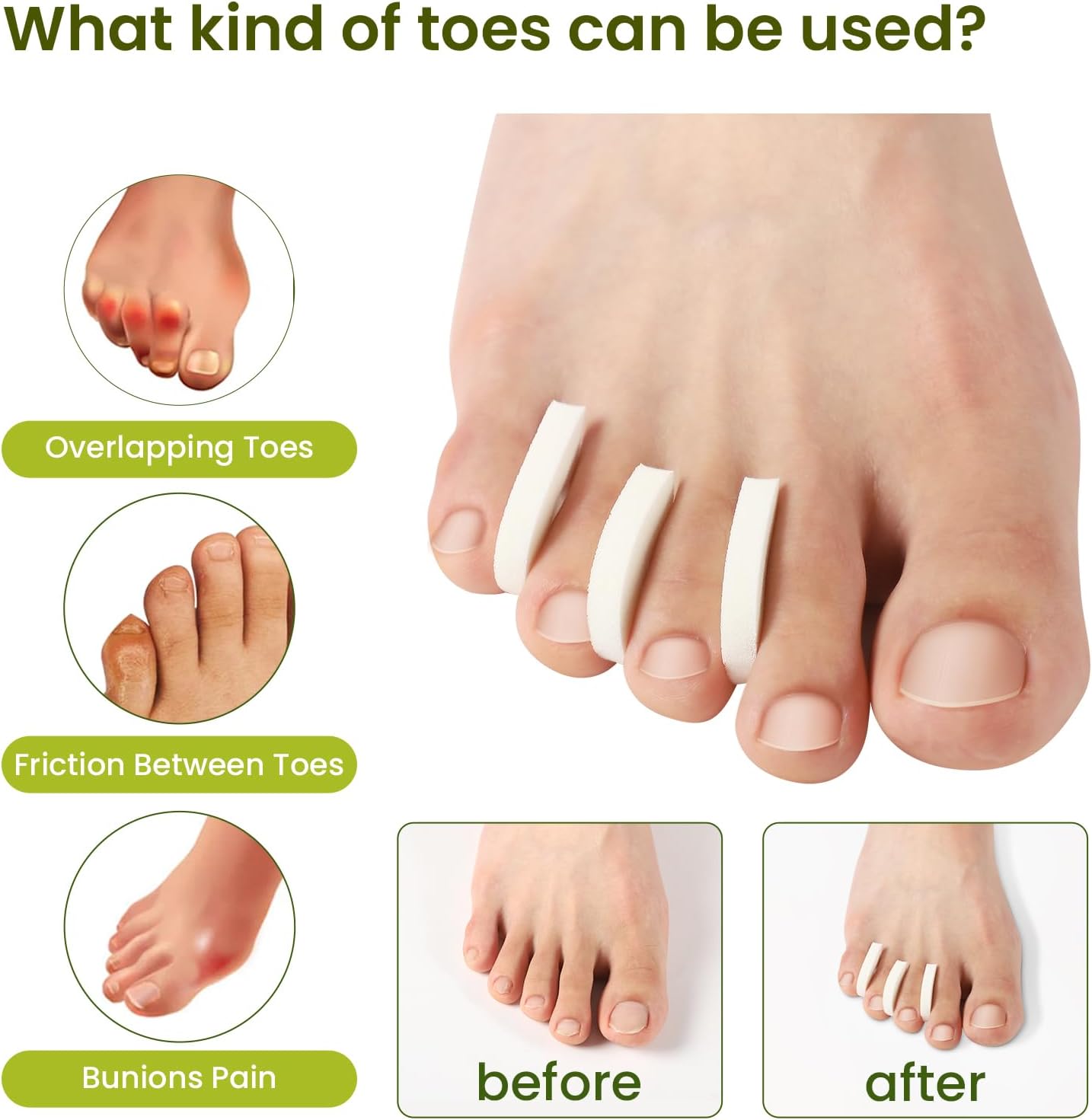 Bukihome 100 Pack Foam Toe Separators - Correct Overlapping Toes and Reduce Friction - Breathable and Comfortable, Foam Toe Spacers for Women