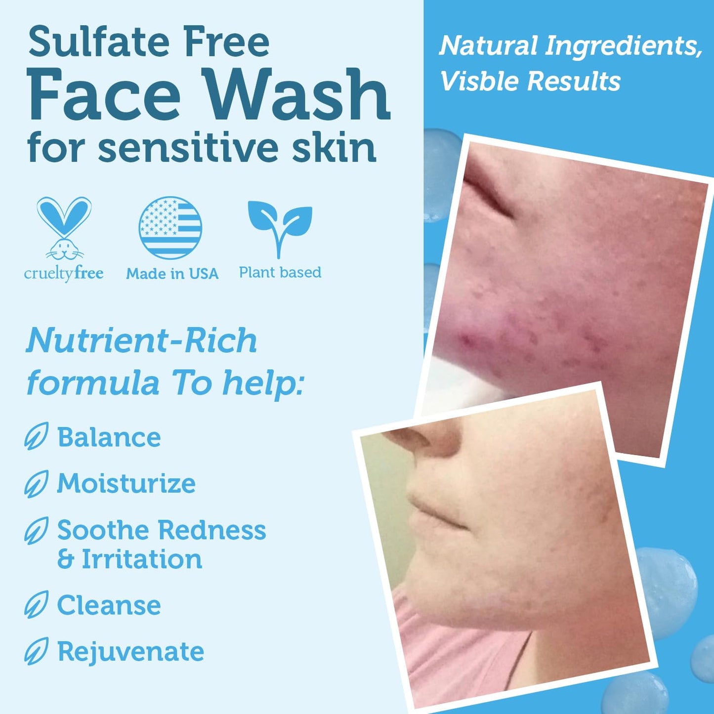 Manuka Honey Face Wash for Women and Men - Sulfate Free Moisturizing Cleanser with Organic Aloe Vera - Soothing Plus Gentle on Dry Skin Facial Cleanser Made in USA - 4oz