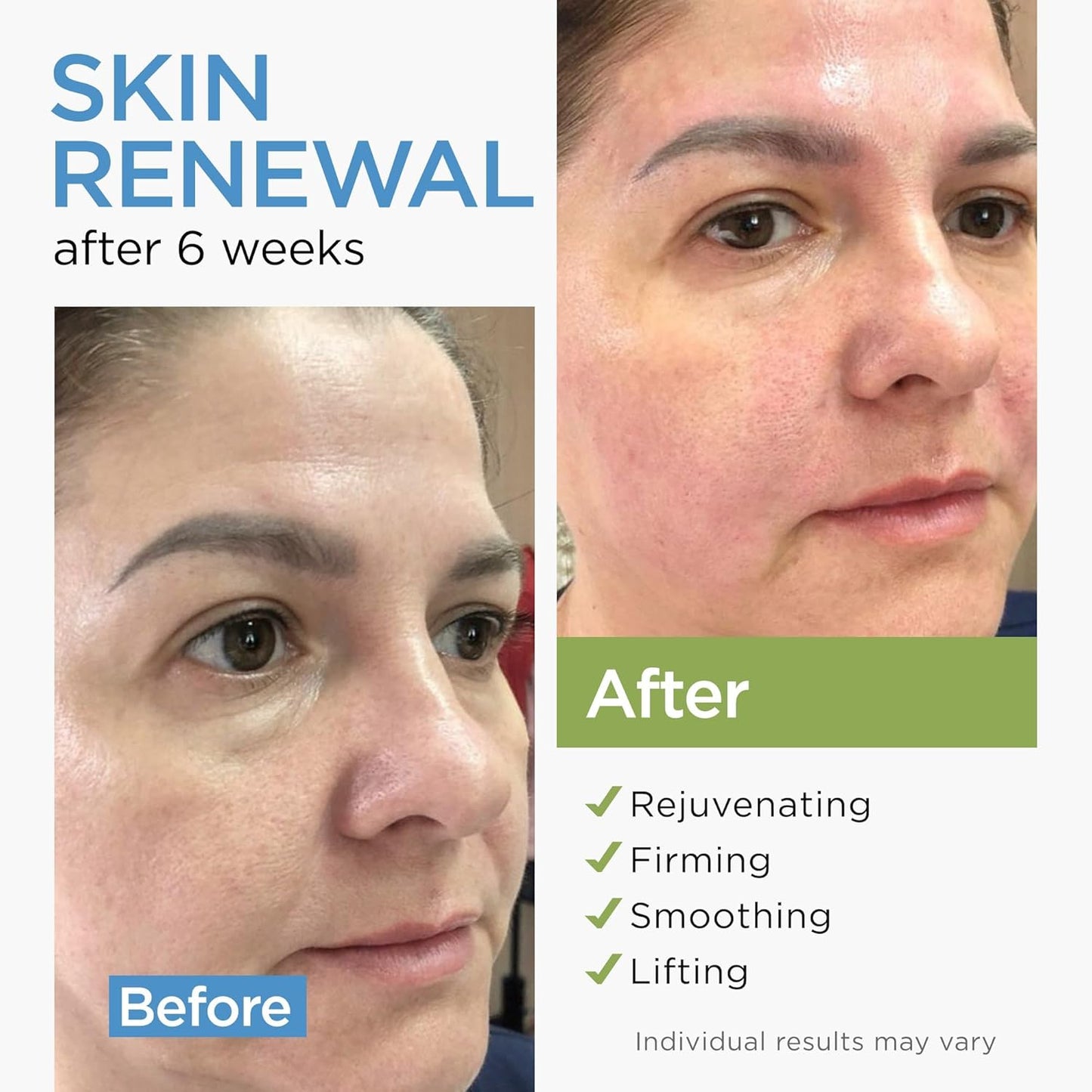 Collagen Face Cream with Stem Cells Retinol Hyaluronic Acid Niacinamide for All Skin Types - Anti-Aging Face Moisturizer with Airless Pump - Day & Night Cream for Wrinkles - Made in USA 1.7 Oz