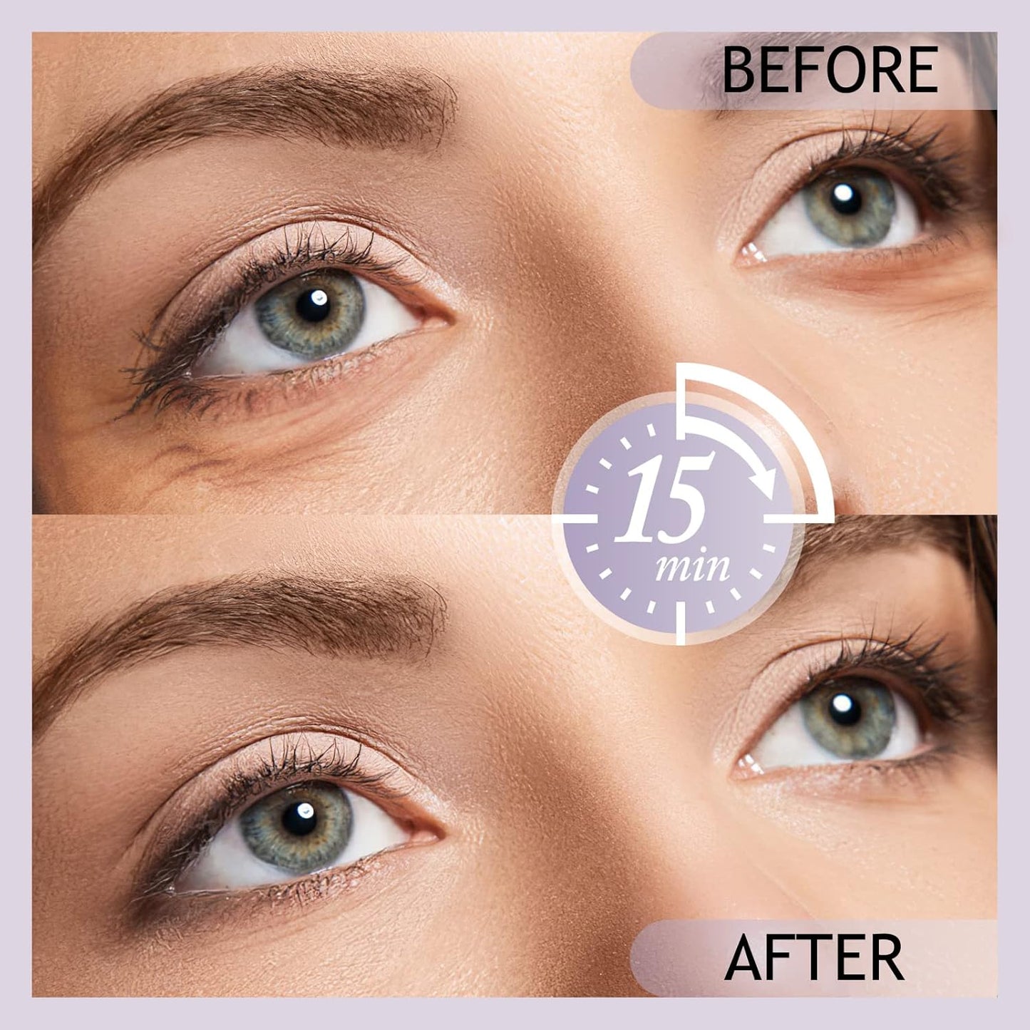 SHVYOG Under Eye Patches (20 Pairs), Under Eye Mask for Dark Circles and Puffiness, Eye Gel Pads for Puffy Eyes, Anti Aging Eye Bags Treatment for Women, Bridesmaid Gifts