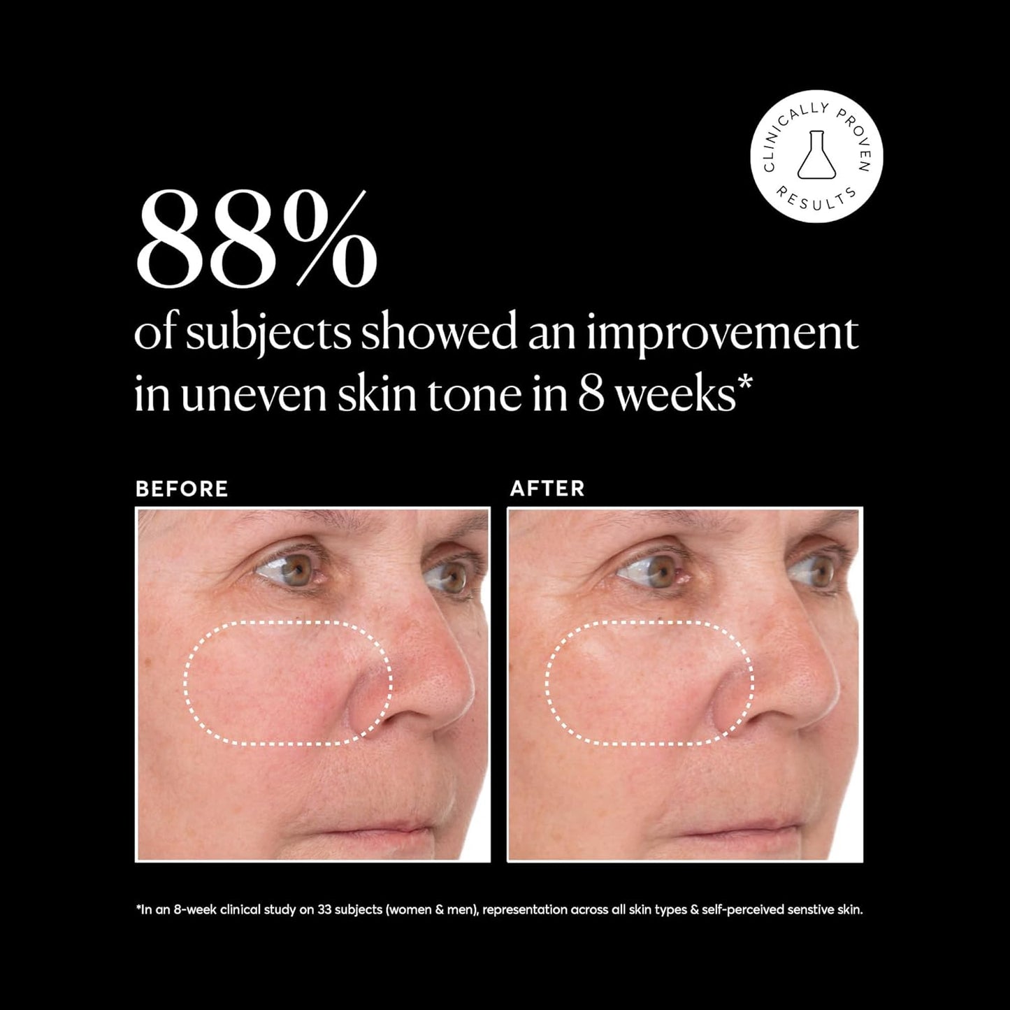 Naturium Vitamin C Super Serum Plus, Smoothing Face Care, plus Retinol, Hyaluronic Acid, Niacinamide & Salicylic Acid, 1 oz