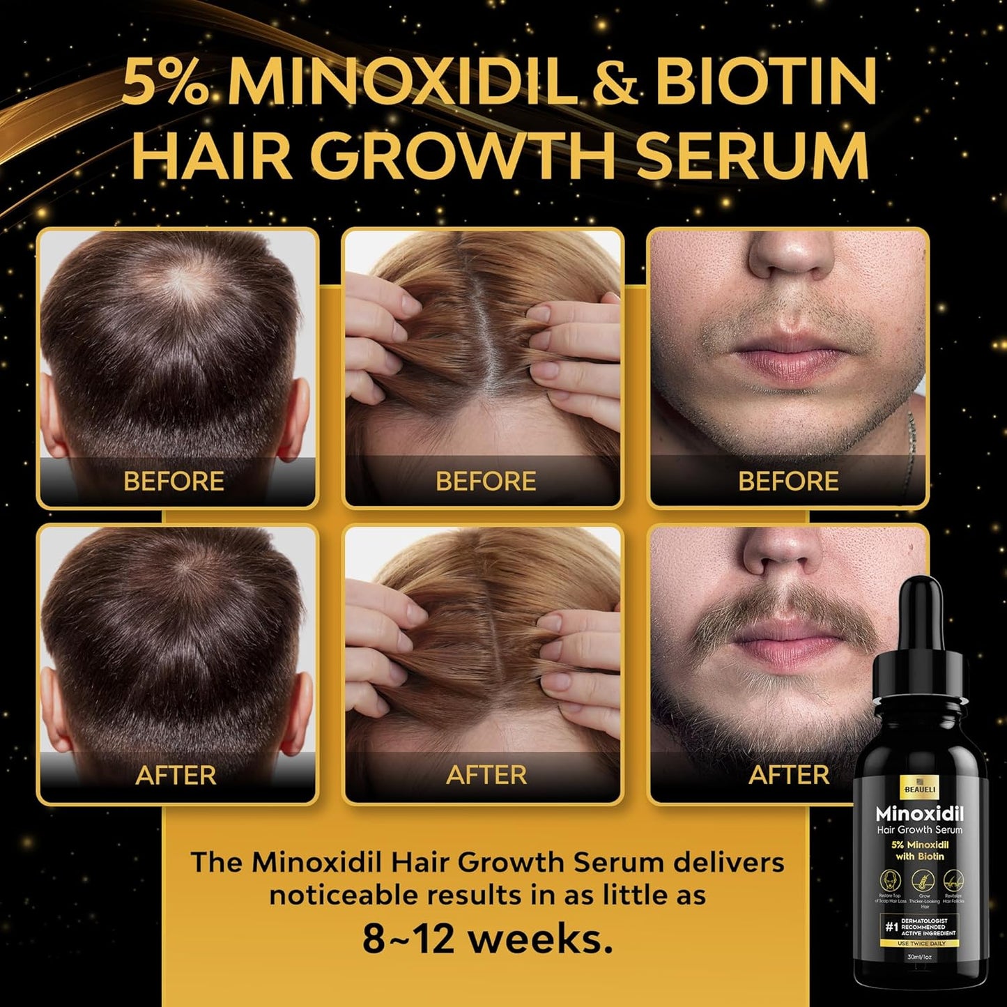 5% Minoxidil for Men and Women, Hair Growth, Beard Growth, Hair Regrowth, Unscented Drop, 3 Fl Oz, 3 Bottles