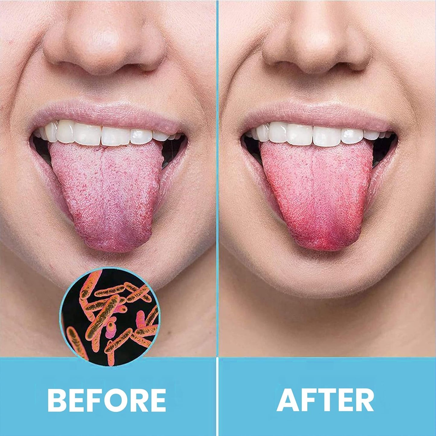 Tongue Scraper for Adults by HOKIN (1Pc Oral Care Pack) Stainless Steel Tongue Cleaners Reduce Bad Breath 100% Metal Tough Scrapers Men and Women Hygiene