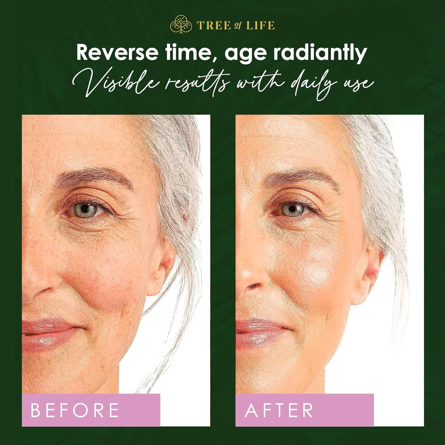 Tree of Life Beauty Retinol Serum, Skin Smoothing Face Oil for Dark and Age Spots and Fine Lines, Facial Serums for Dry and Sensitive Skin Care with Hyaluronic Acid for Soft Smooth Skin, 2 Fl Oz