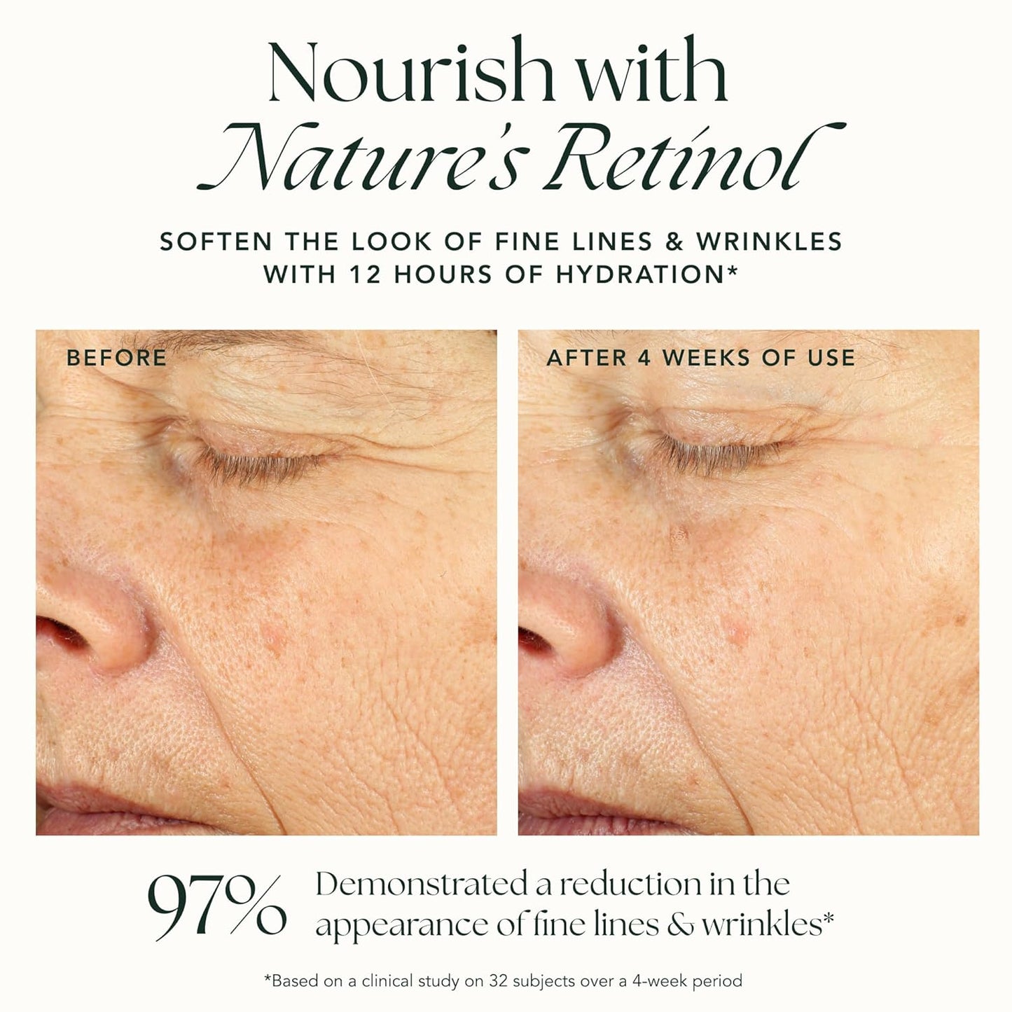 RANAVAT Renewing Bakuchi Face Cream - Daily Face Moisturizer with 12 Hour Hydration to Boost Skin Barrier Function - Softens Fine Lines + Wrinkles with Lotus Flower, Bakuchi & Ashwagandha (1.7 oz)