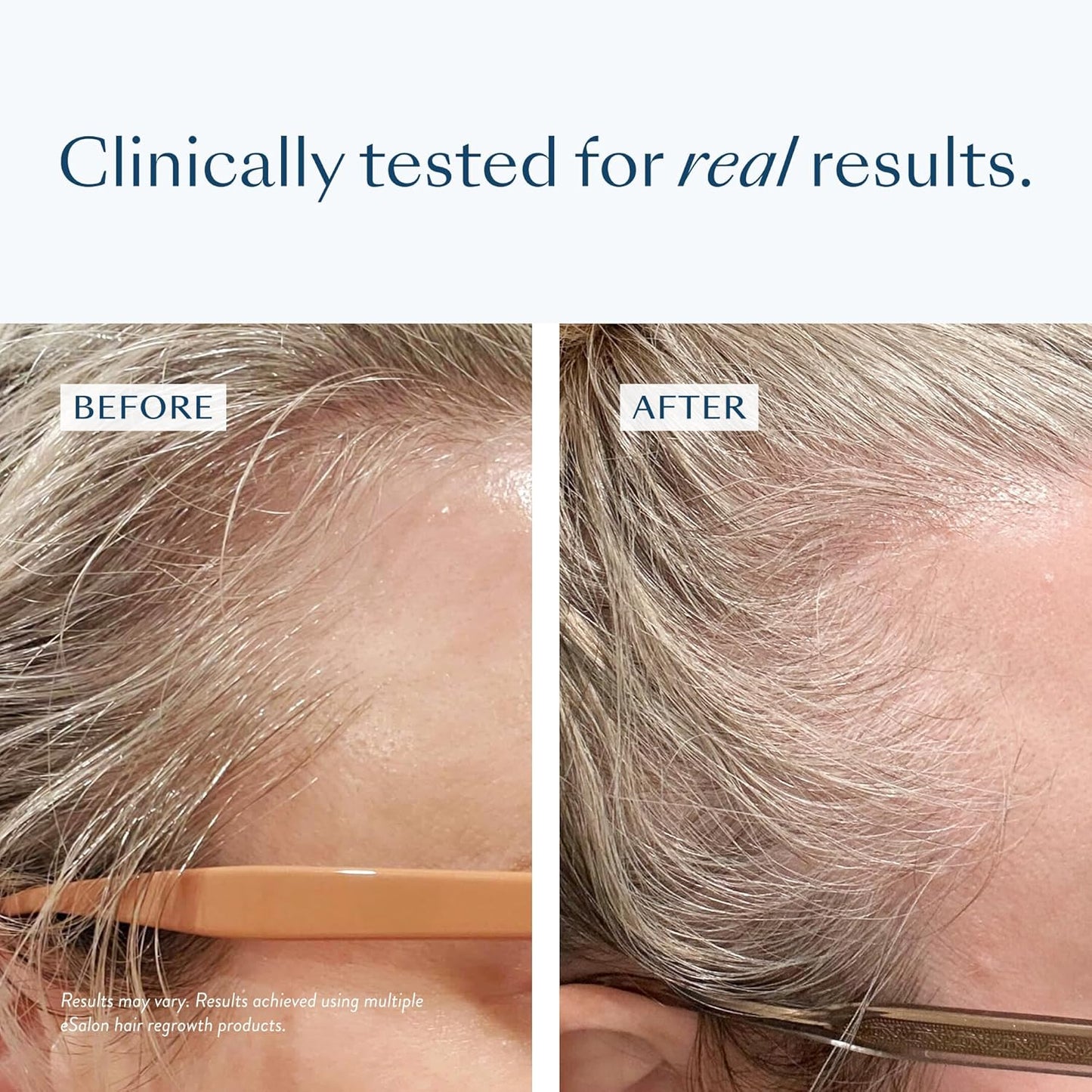 eSalon Soothing Scalp Serum with Biotin and Copper Tripeptide, Antioxidant-Rich Formula, 1 fl oz