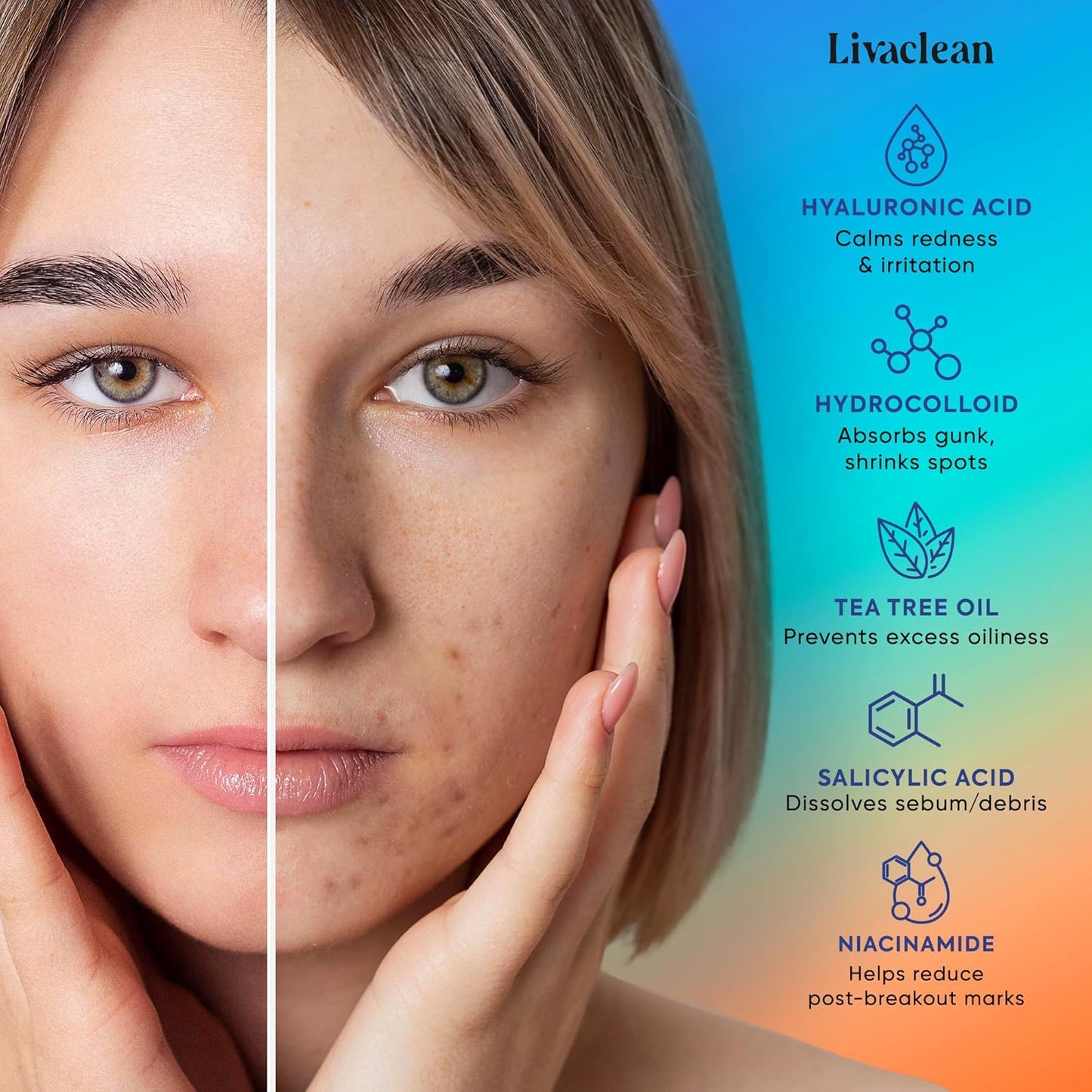 LivaClean 18 CT Microdart Acne Patch – Pimple Patches with Salicylic Acid & Tea Tree Oil – Dark Spot Patches for Face, Blemish Dots, Deep Pimple Patch, Salicylic and Hyaluronic Acid