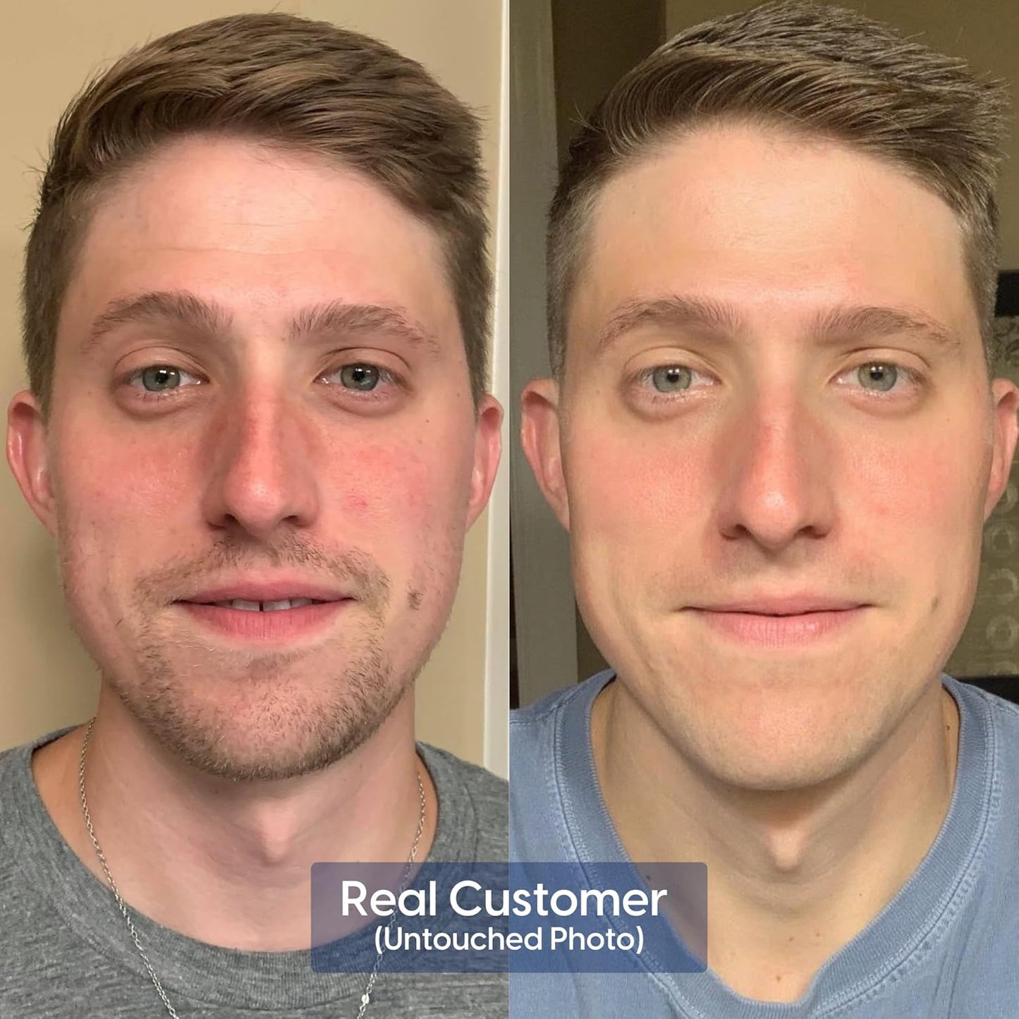 Strive - Anti-aging Retinal Serum - 0.1% Retinaldehyde, 10% Peptides & 2% Vitamin C E Ferulic Face Serum. Brightening, Firming, Wrinkle & Fine Line Reducing - Fragrance Free Anti aging Skincare - 30mL