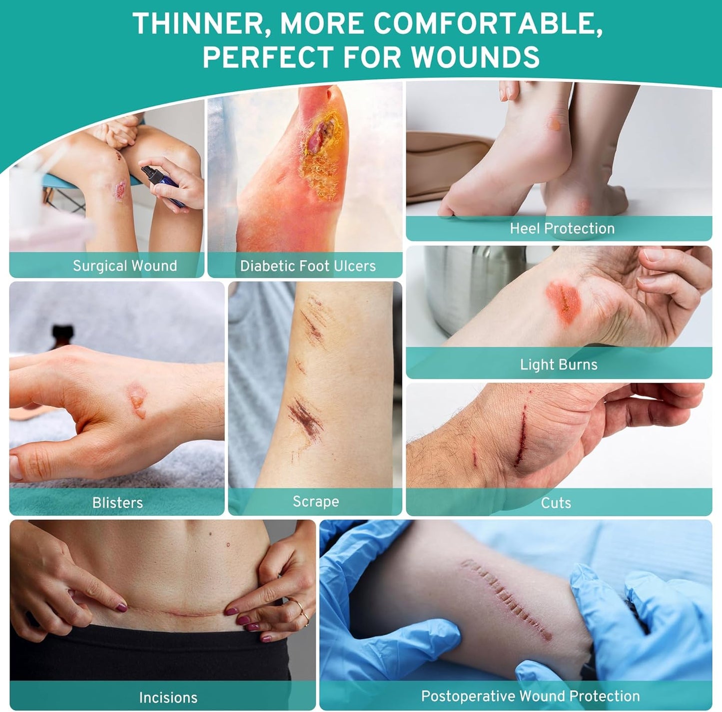 Upadated Hydrocolloid Bandages,2in*12ft Hydrocolloid Roll for Wound Care,Medical-Grade Hydrocolloid Patch Bandages with Self-Adhesive, Flexible & Waterproof DIY Size & Shape