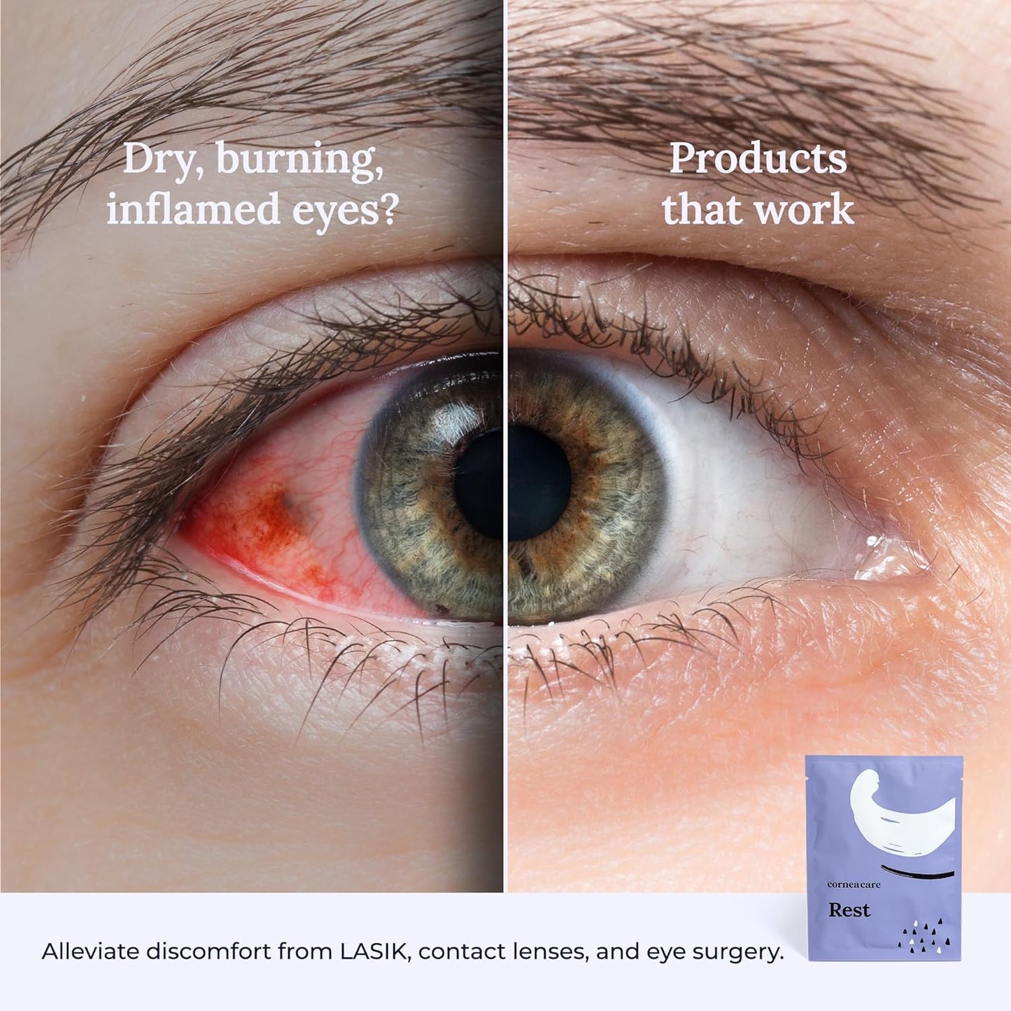 Rest: Self heating warm compress for dry eye | Heated eye Mask for fast relief | No microwave or washcloths needed | Travel ready | 90 counts